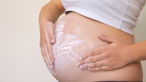 STRETCHMARKS IN PREGNACY