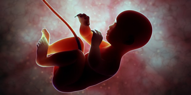 ABORCJA