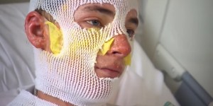 Iz goreče hiše rešil nečakinjo: &#8220;Raje vidim, da ogenj ožge mene kot njo&#8221;