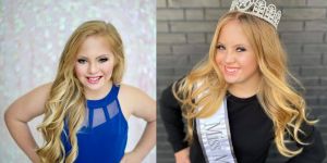 Mis z Downovim sindromom: “Moja invalidnost lahko spremeni svet”