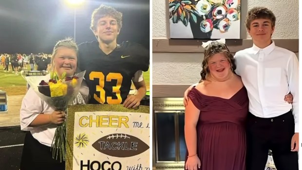 Cheerleader with down syndrome