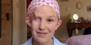 Rak ji je vzel desno oko, a ona širi dobro voljo: “Mar ni vsak od nas malce drugačen?”